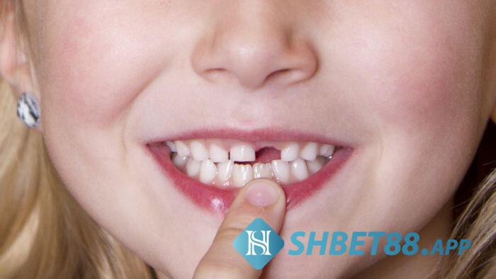 Nằm mơ thấy rụng răng có điềm báo gì? Đánh số mấy? 6 Mộng bị rụng răng hàm trên